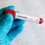 Impianti idraulici antilegionella: normative, soluzioni ed errori da evitare